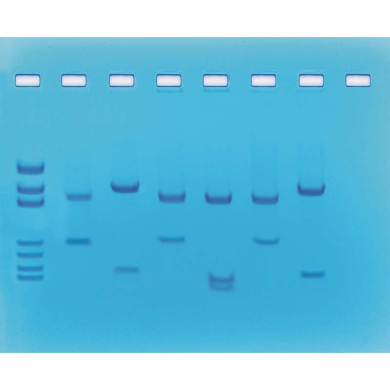 Edvotek Activity Kit – DNA Fingerprinting Using Restriction Enzymes